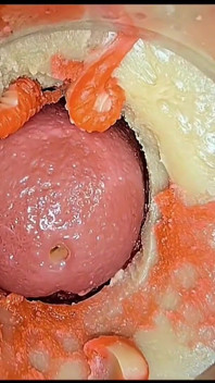 Compilation Di Creampie Parte 5 POV