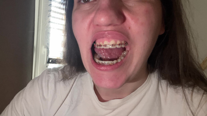 NicoleRay: Mit der Zunge die Zahnspangen lecken