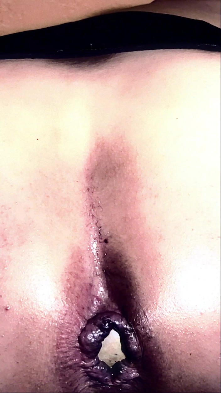 kandiKane: 娘娘腔荡妇坎迪肛交玩pmv人像模式