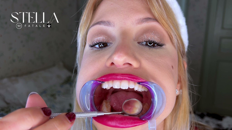 Stellafatale: Examen des dents avec retrait de la bouche