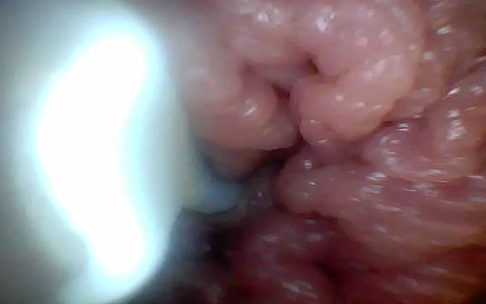 Twittiy: Endoskopová kamera ukazuje nejcitlivější části vzdělávacího videa penisu