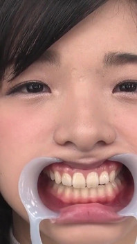 Pozorování zubů přírodní zuby, ale potenciální dutiny nalezeny !! Kráska winces, když jí zuby jsou poklepané - Suzu Shiratori