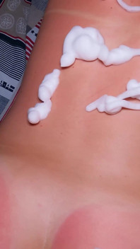 La mia sorellastra è stata scottata dal sole e ha chiesto aiuto!