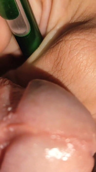 Applying Shocks to the Penis with the Electric Pen.