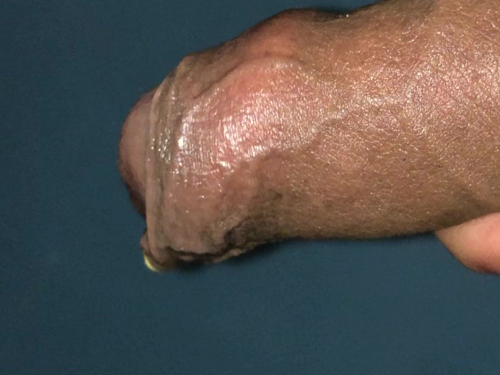 MisterFreak25: Mexican Foreskin Fat Cock Jerking off off at All the...
