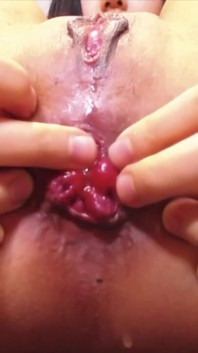 Tiny Asian fucking her prolapse rosebud