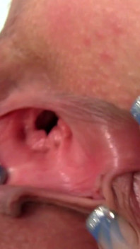 I hunt my cunt - nurse Lucie looks into her pussy with speculum in gynecological surgery