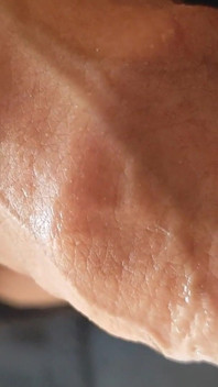 Neobřezaná fimóza má první ejakulaci.