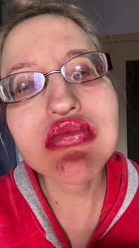 Reuzine grote lippen grote bril verleidend onderbroek eiwitreep