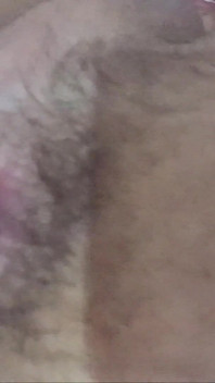 Anal Gap