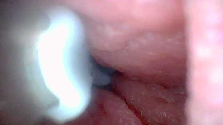 Twittiy: Vamos dar uma olhada na minha buceta suculenta juntos (câmera de...