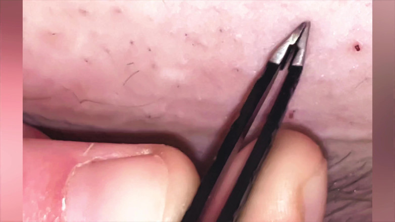 SatisfyingDillyDally: Memetik diri saya