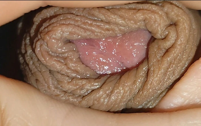 Straight Daddy Club: Boy with Large Anal Phimosis Excited!