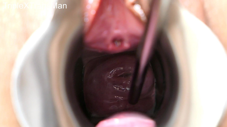 TripleXTransMan: Penetrace mého děložního čípku!