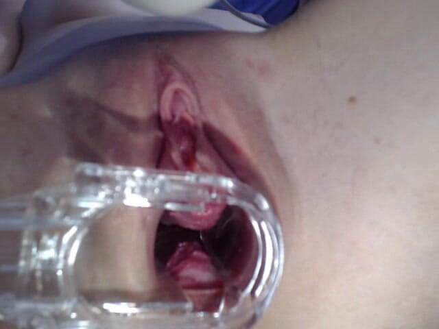 Brooke Dillinger: V12 膣を広げてスペキュラムオーガズム