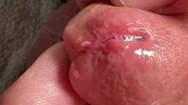 ペニスの指。ペニス挿入の穴。