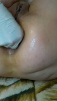 Fisting Diri Dubur