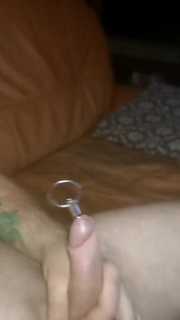 카테터와 음향봉을 완전히 삽입한 사운싱