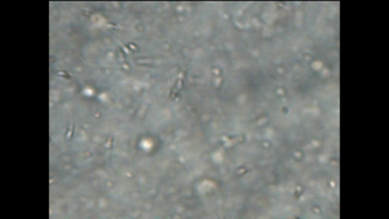 Mark Hannes: Sexdoll Creampie Stand Fuck Masturbation with Sperm Under the Microscope