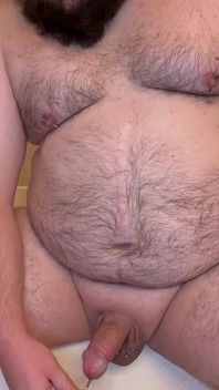 Pierced Chubby Guy Sounding with 3mm - 4mm and 5mm - 6mm Hegar