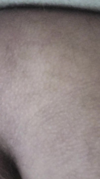Dirty Anus