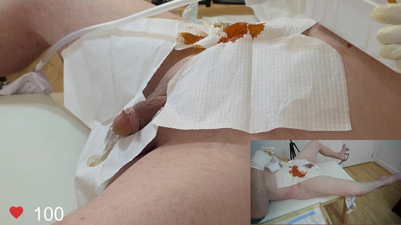 Clinical Climax: Kathetereinschub