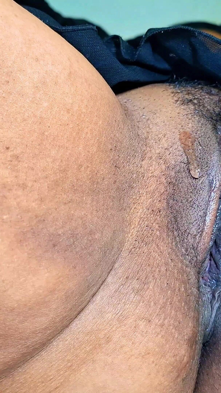 Casal Mattos: Ela Pediu Todos Os Dedos E a Mão Inteira Na...