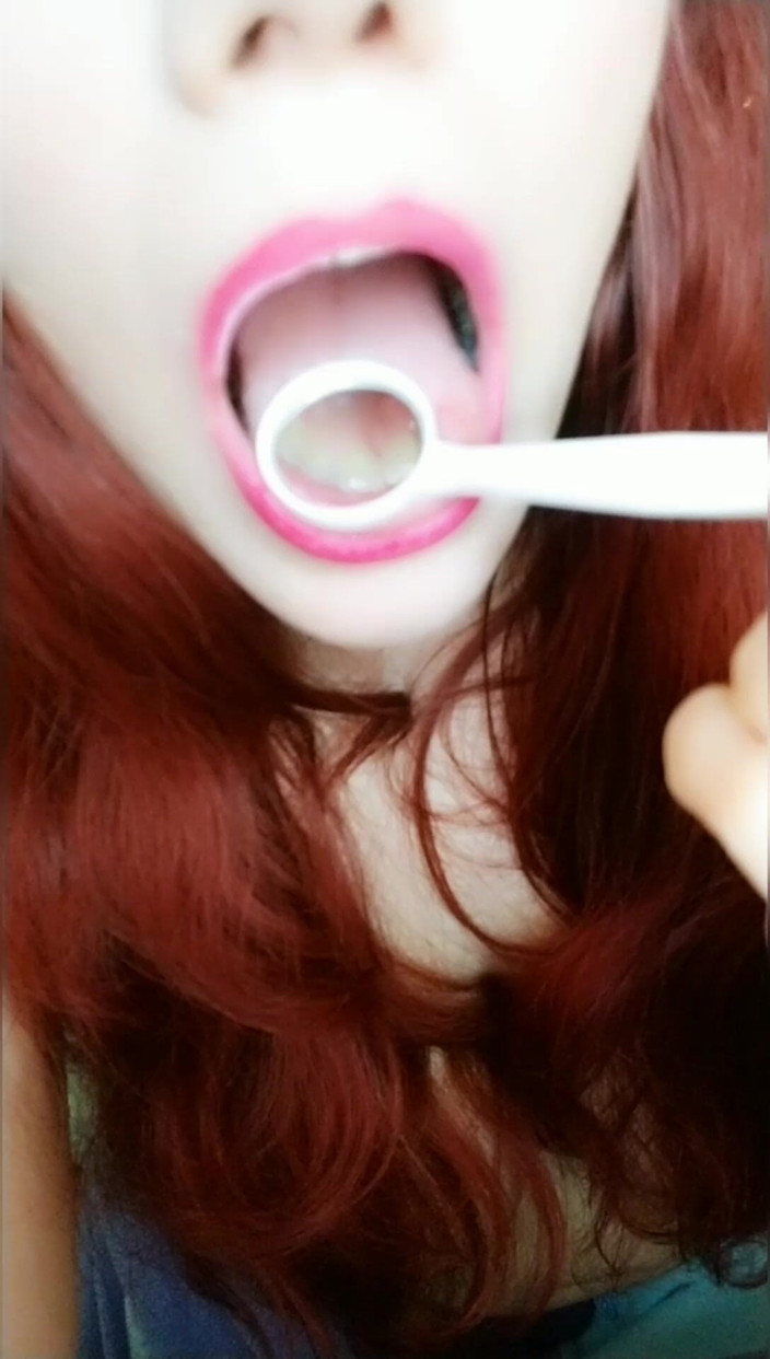 Scarlet Vixen: Kontrola lustra dentystycznego