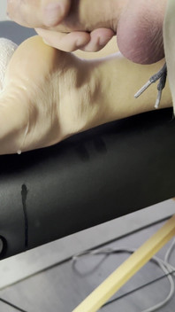 The Lollipop Couldn’t Handle the Pressure