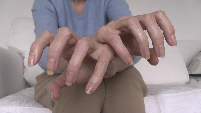 Lady Victoria Valente: Tangan dan kuku yang cantik dan elegan yang disampaikan oleh...