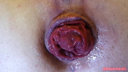 Violet Buttercup: Anale estremo con prolasso