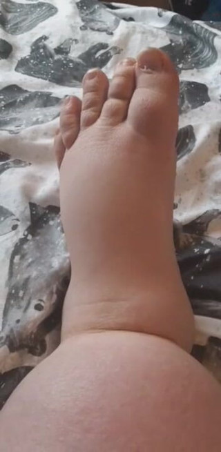 SSBBWLadyBrads: Fat chubby feet