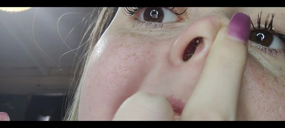 RavenHearth666VIP: Runny Nose Close up