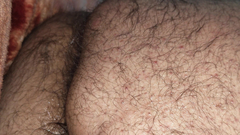 Danilol: Masturbação anal