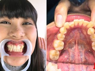 Japan Fetish Fusion: Diş hissi: fırçalama, hassasiyet ve entrika