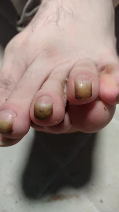 Unleashing the Beauty of My Naked Feet for You