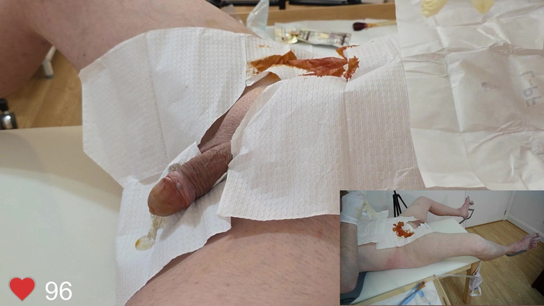 Clinical Climax: Inserción de catéter