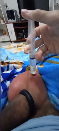 Injection saline de 60 cm3 dans chaque œuf
