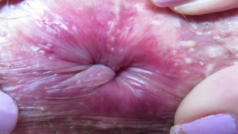 Cuteblonde666: Closeup ekstrem di duburku yang berkedip