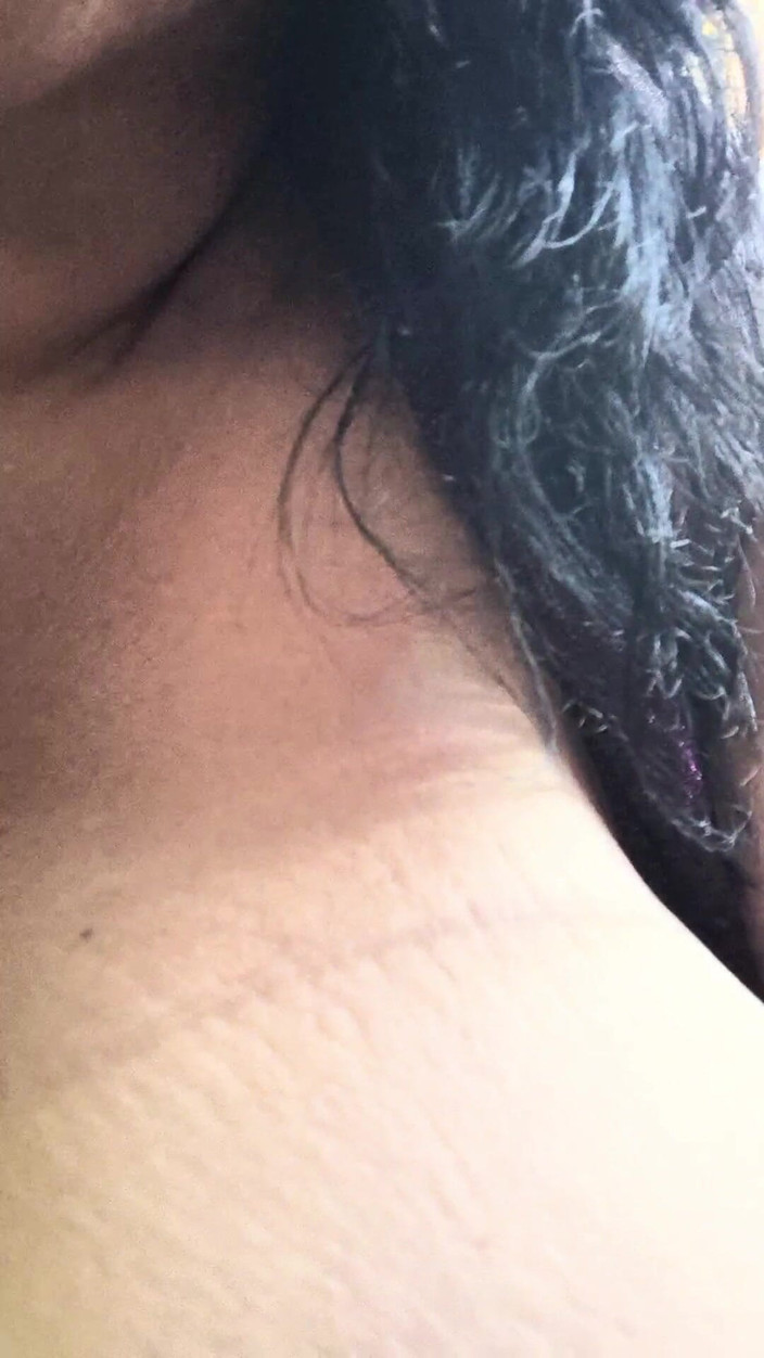 HerculesnVENUS: Cadılar bayramında ormandan daha ürkütücü nedir? Aslında azıyor ve arkadan fışkırtıyor