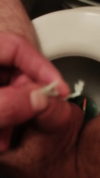 Mé Zasuvání Tamponu Do Močové Trubice Penisu