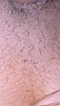 Nutzloser penis