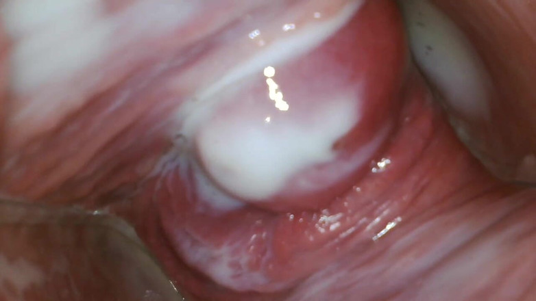 JANA studios: Endoscope in my pussy