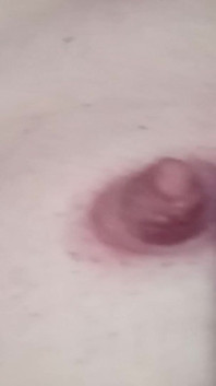 Nipples