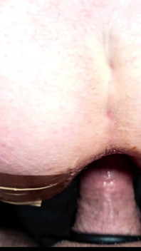 Fill Hairy Anal (sex Anal Creampie)