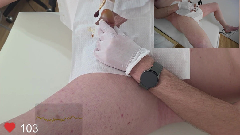 Clinical Climax: 16 Franse Foley Invoeging