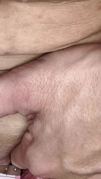 Đo âm vật lớn & so sánh