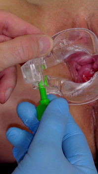 Examen cervical d’une jeune musulmane Zeynep Rossa