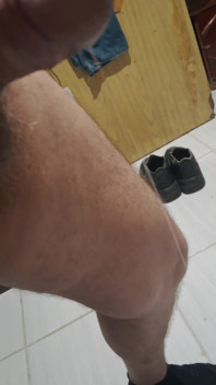 Porra Vazou E Ficou Pendurada No Pinto