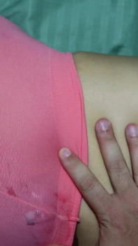 Cewek ini dicrot skandal di belly button